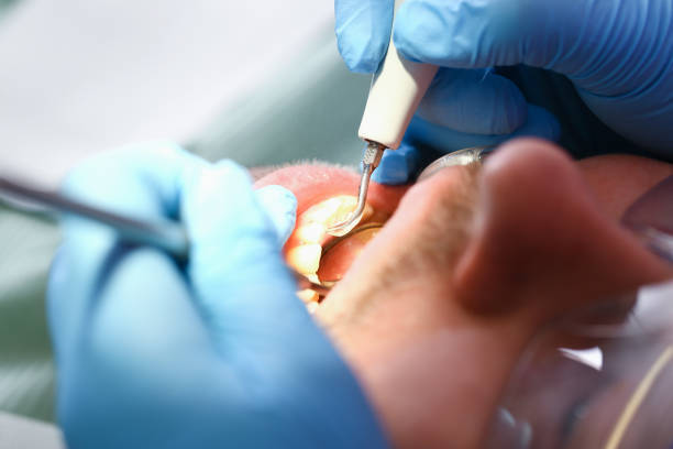 Best Emergency Tooth Extraction in Trexlertown, PA