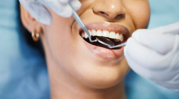 Best Emergency Treatment for Dental Infections or Abscesses in Trexlertown, PA