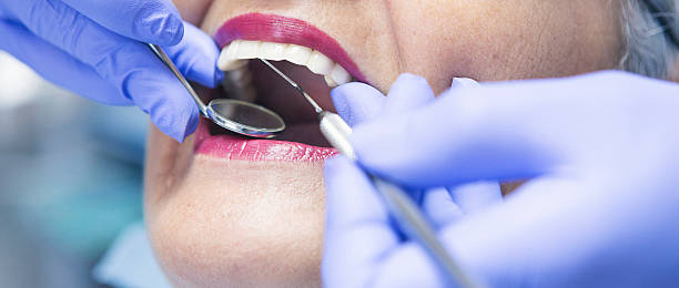 Best Urgent Care for Lost Fillings or Crowns in Trexlertown, PA